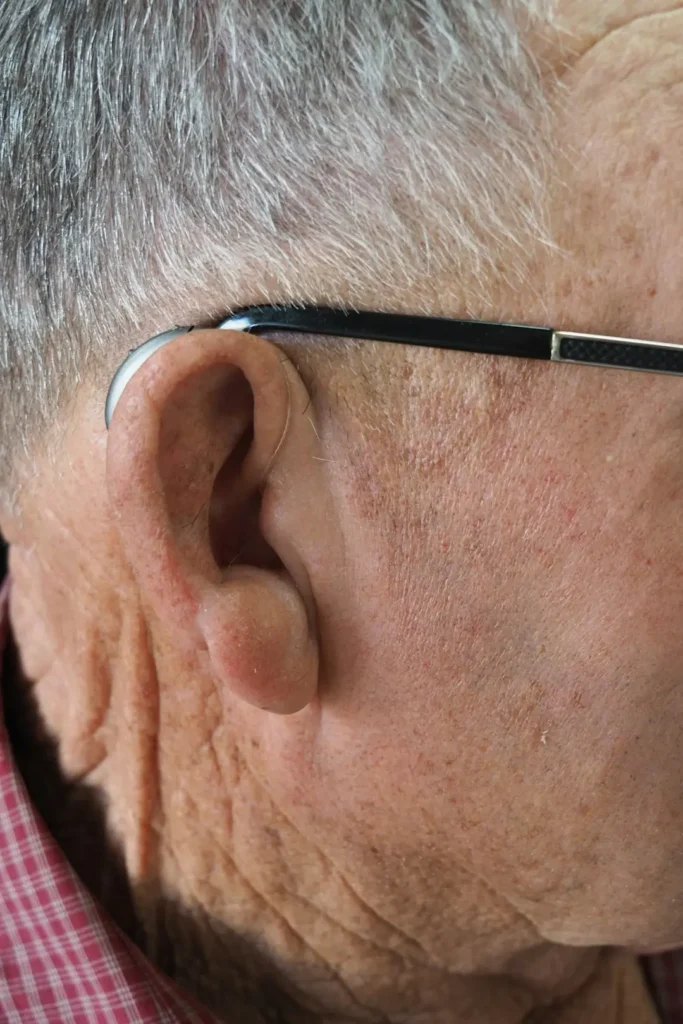 hearing aid fitting